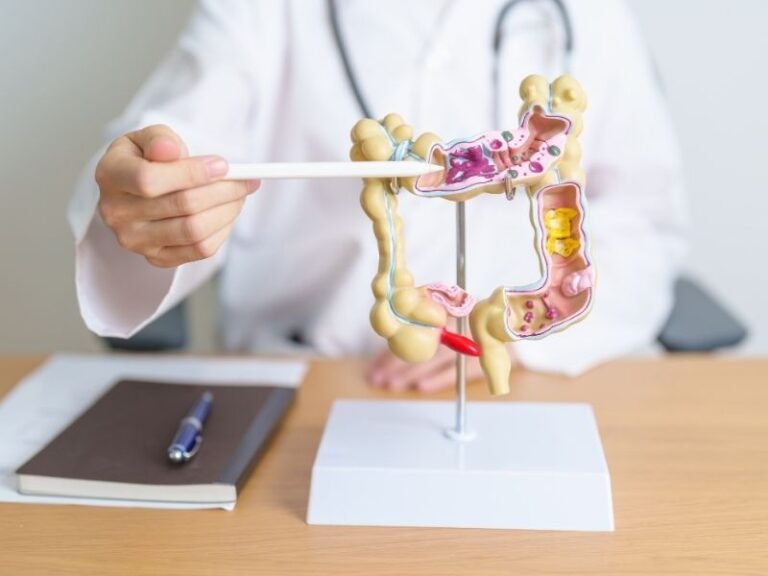 Cirurgia para Cancer Gastrointestinal em Curitiba