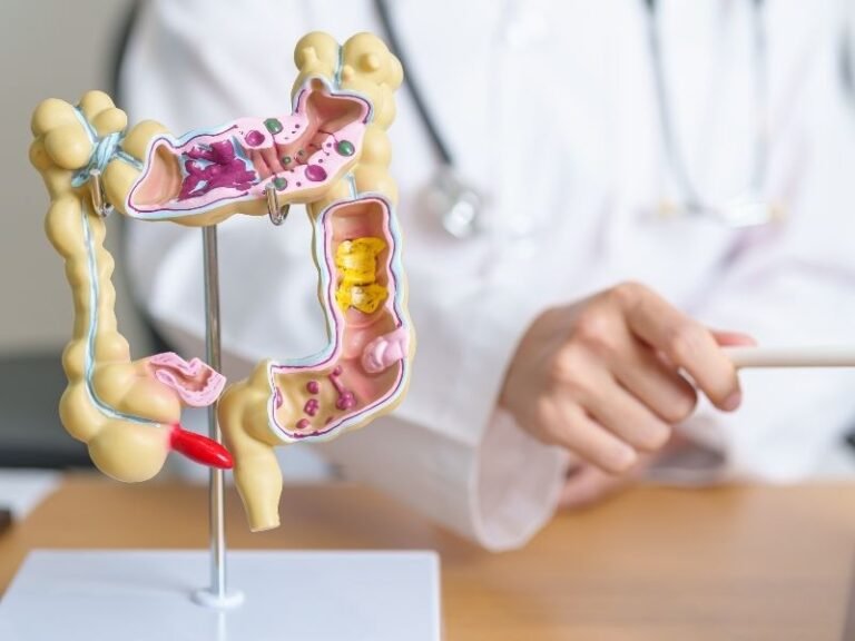 Cirurgia para Refluxo em Curitiba
