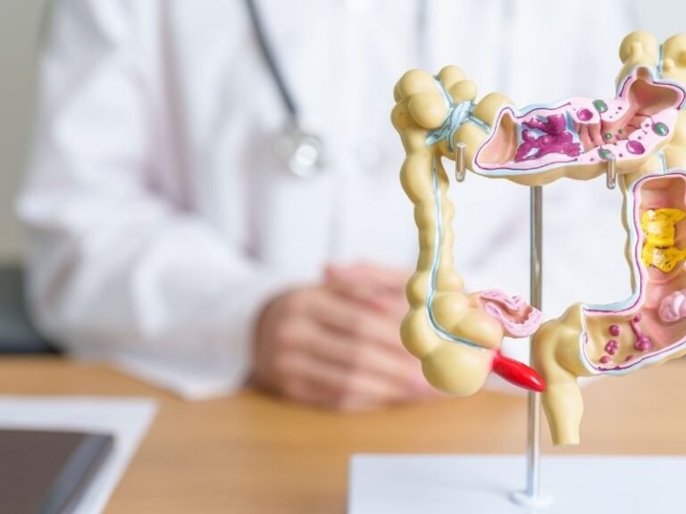 Tratamento de Cisto Intestinal em Curitiba