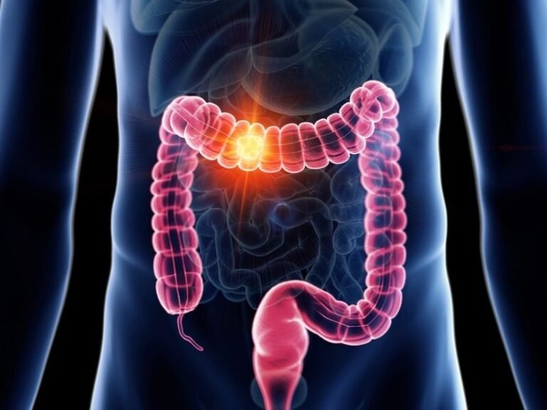 Tratamento de Problemas de Motilidade Gastrica em Curitiba