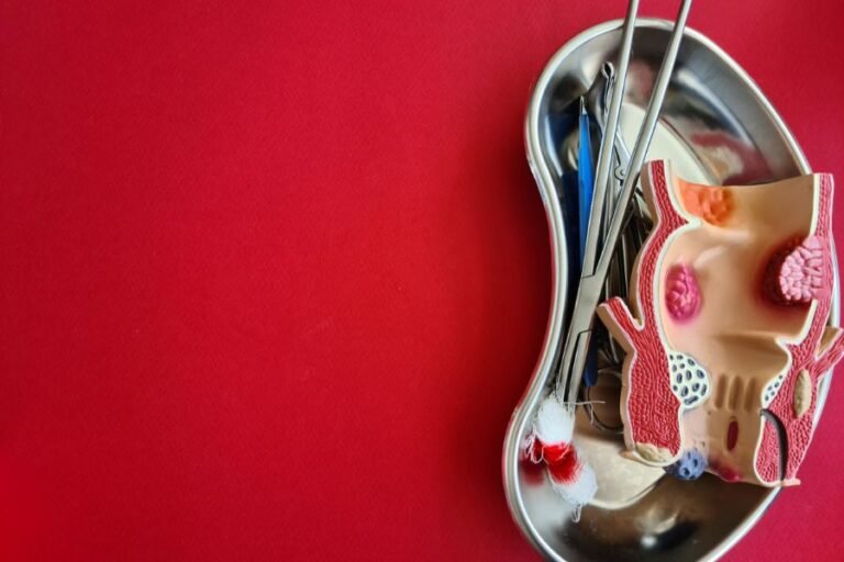 Plicoma Anal com Infeccao Fungica Como Tratar a Coceira e o Inchaco em Curitiba